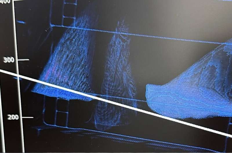 AI 算法助力打击海洋野生动物走私，识别准确率达 92%